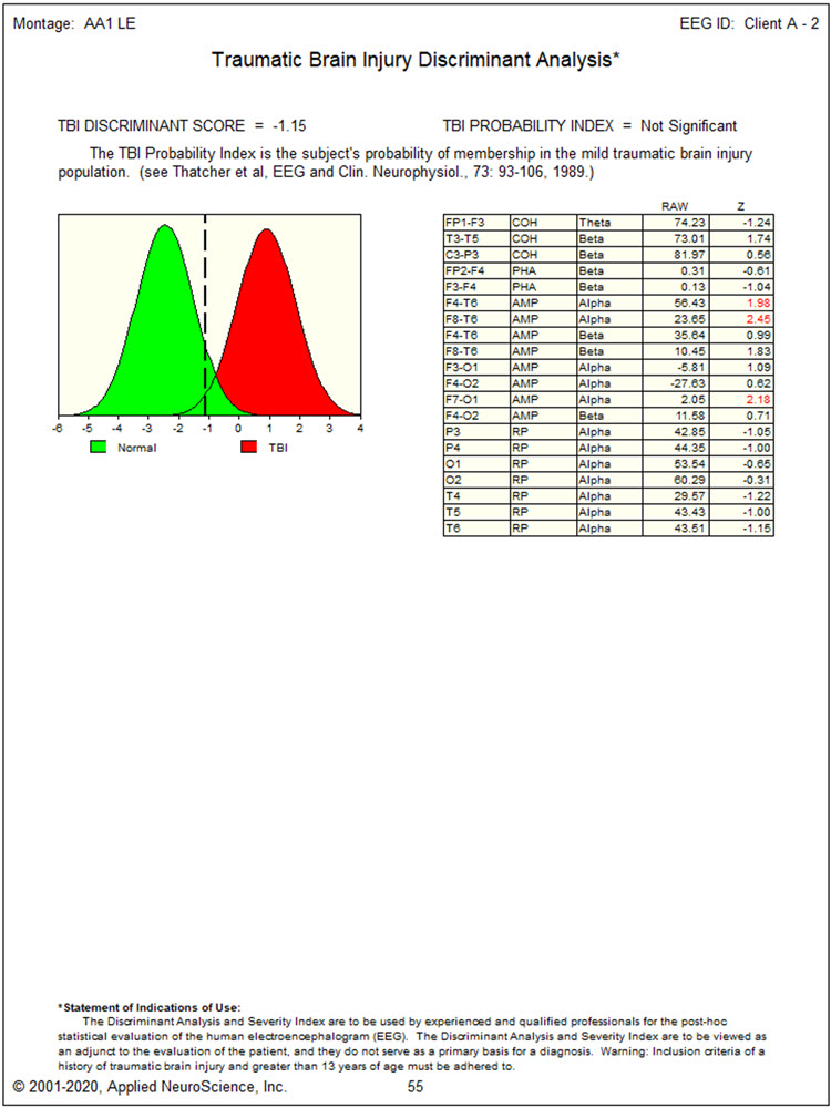 Second recording TBI discriminant analysis showing non-significant values